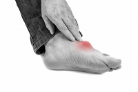 Possible Risk Factors For Developing Gout