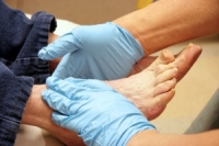 How Feet Are Affected by Diabetes
